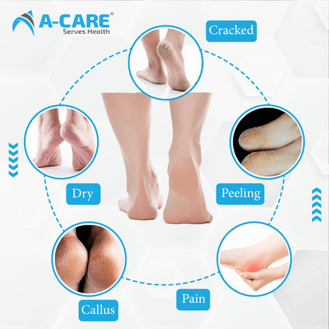 Acare Silicon Gel Socks